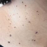 7 Gentle Nighttime Habits to Support a Lighter, Happier Colon