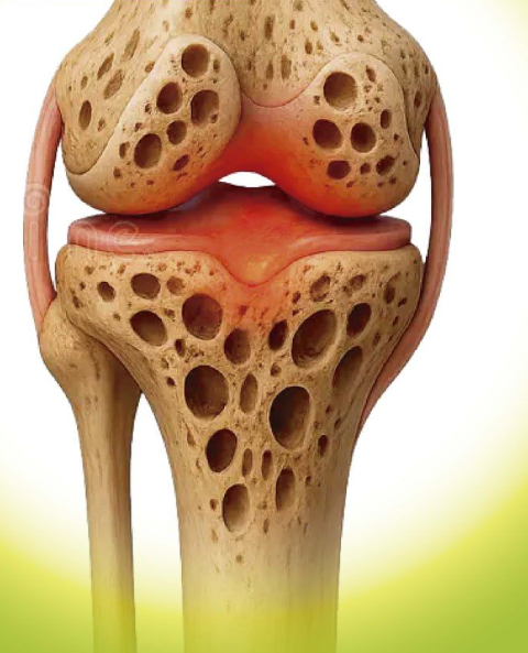 Could Bone Broth Support Healthy Knee Cartilage as You Age?