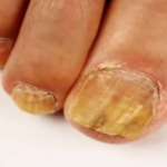 I Haven’t Been Sick for 35 Years — My Mind Is Clear, My Vision Is Sharp, and My Blood Pressure Is Steady: The Garlic & Ginger Habit That Changed Everything