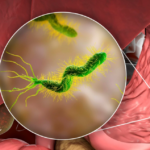 Homemade Natural Painkiller: A Simple 3-Ingredient Remedy for Fast Relief