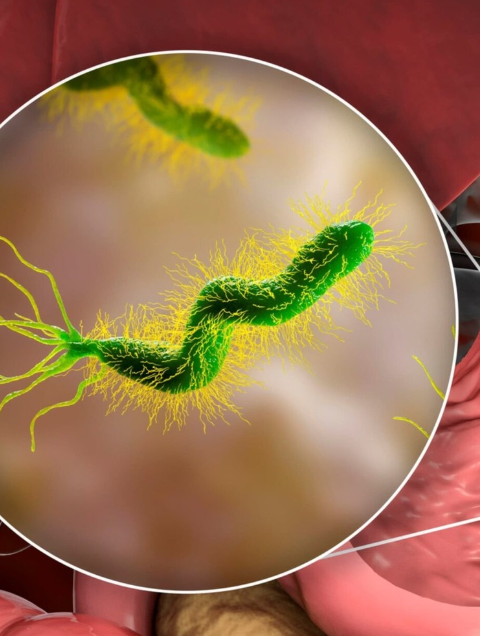 H. Pylori Explained: The Hidden Stomach Bacterium, Terrain Imbalance, and True Root-Cause Healing