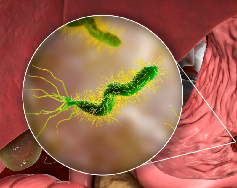 H. Pylori Explained: The Hidden Stomach Bacterium, Terrain Imbalance, and True Root-Cause Healing