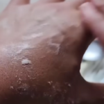 5 Natural Home Remedies for Cracked Heels (That Actually Work)