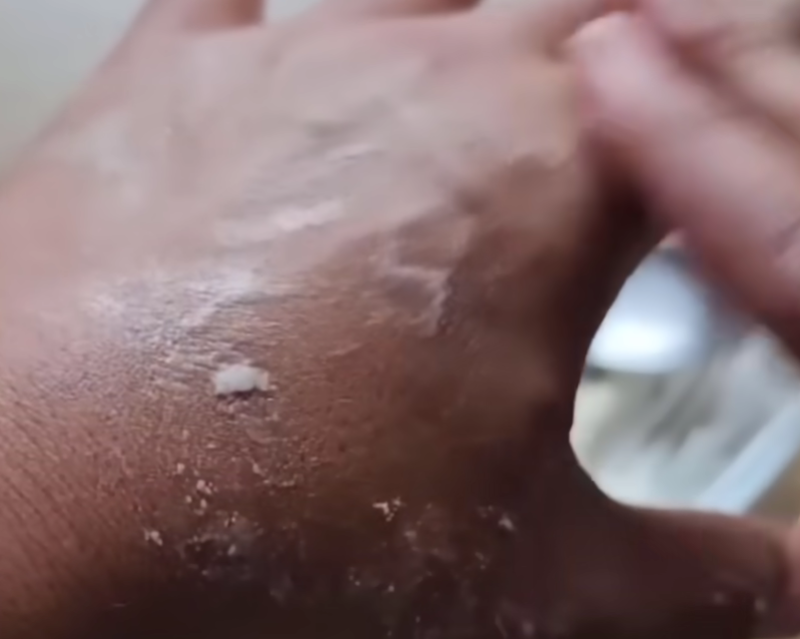 How to Remove Age Spots, Melasma, Sun Spots, Dark Marks, and Signs of Skin Aging Naturally