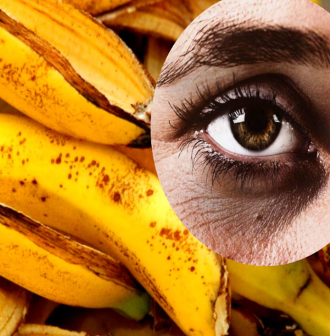 Banana Peel for Dark Circles: I Tried It—and Here's What Happened