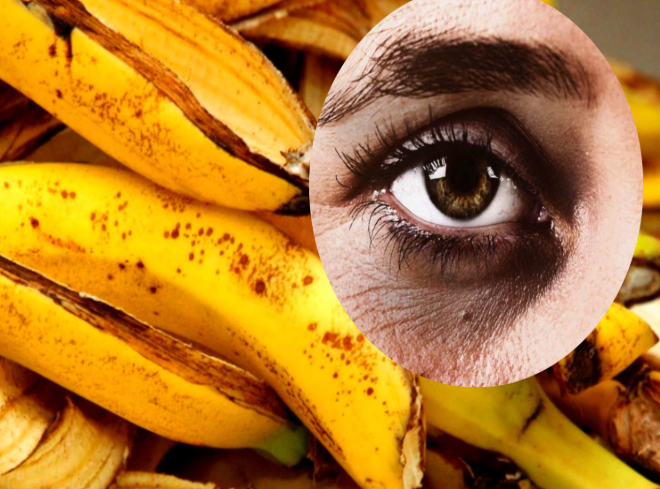 Banana Peel for Dark Circles: I Tried It—and Here's What Happened
