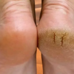 8 Silent Signs of Nerve Damage Starting in Your Toes You Might Be Ignoring