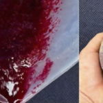 The “Golden Syrup” Secret: Onion and Honey Cough Remedy