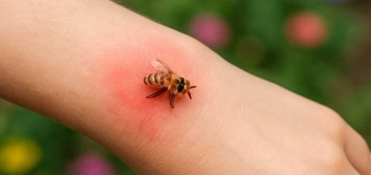 I Didn’t Know This — But My Dad’s 1-Minute Bee Sting Trick Works Like Magic