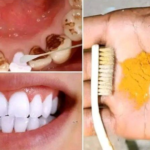 Doctors “Reveal” Morning Coffee Causes