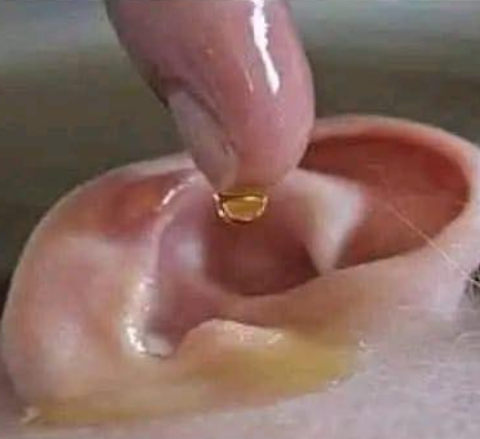 Hearing Loss: What Really Causes It — And What You Can Do