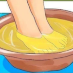 Unexplained Bruising? What It Could Mean and When to See a Doctor