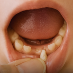 Identifying Small Glass Tubes Containing Three Tiny Ball Bearings