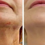 My Grandma’s Morning Drink That Helped Her Beat Diabetes, High Blood Pressure, and Fatty Liver Naturally